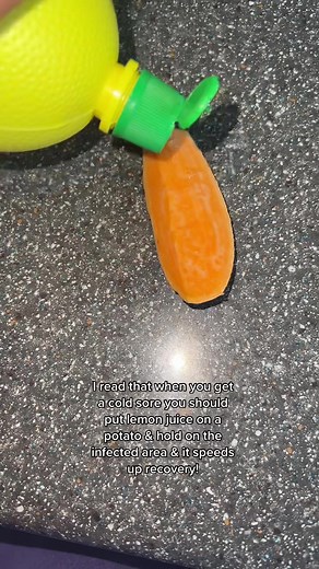 Effective Cold Sore Remedies: Lemon Juice on Potato