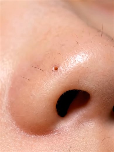 Professional Pore Cleansing Session Revealed