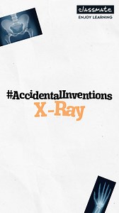 Dive into the illuminating tale of Wilhelm Roentgen, the accidental trailblazer behind X-rays! 🌟💡 What began as an experiment with cathode rays turned into a revolutionary discovery that penetrated the unseen. 🔬🚀 Follow us now! To explore more fascinating accidental inventions. #AccidentalInventions #28DaysofScience #Classmate #LearnWithClassmate #EnjoyLearning #Trivia #science #sciencefacts #scienceforkids #inventions | Classmate