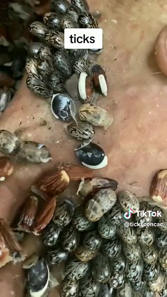 Ticks are a real nuisance to people #ticks #foryou #fyp