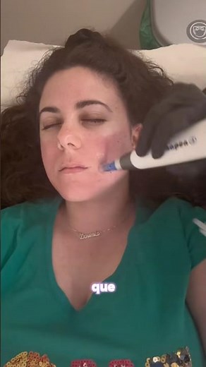 DERMAPEN: Qué es, cómo funciona, duele y proceso