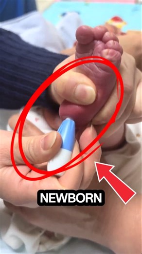 Doctor Needed Blood Sample of New Born