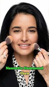 7 Plastic surgeries that went heartbreakingly wrong. Sometimes, less is truly more. ⚠️