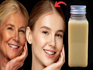 Anti aging homemade serum - Remove wrinkles and fine lines - Million times stronger than botox #AntiAging | Simple Home Remedies