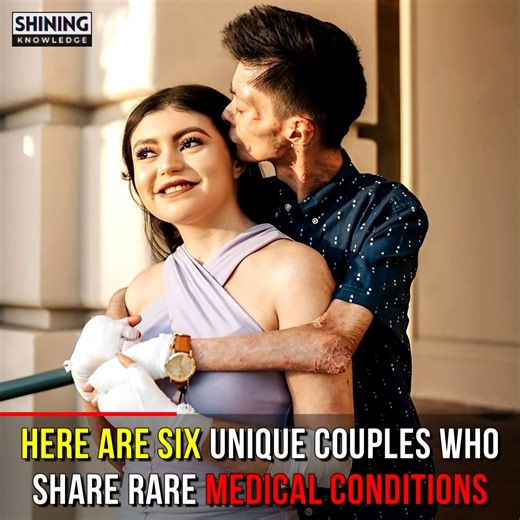 110K views · 2K reactions | Here Are 6 Unique Couples Who Share Rare Medical Conditions | Shining Knowledge | Facebook