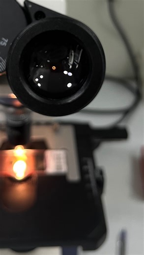 Zibeyda Gambarova | MD on Instagram: "🪱 Ascariasis — the Most Common Helminth Infection Worldwide Ascariasis is a parasitic disease caused by the nematode Ascaris lumbricoides. According to WHO estimates, hundreds of millions of people are infected worldwide, mainly in regions with warm climates and limited sanitation. 🔬 Transmission and Life Cycle Infection occurs through ingestion of embryonated (infective) eggs from soil contaminated with human feces (via contaminated hands, unwashed vegeta