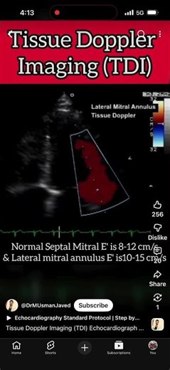 TDI # Tissue Doppler Imaging # lateral septal