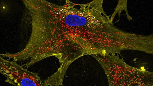 Scientists boost 'tiny batteries' within our cells in hopes of slowing effects of aging