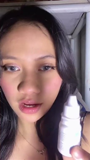 Contact lenses