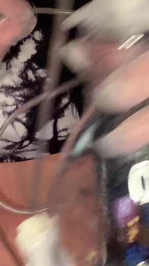 *TRIGGER WARNING* MEDICAL PROCEDURE PleurX catheter drain pt 2 #stage4cancer #skincancer #melanoma #pleurxdrain