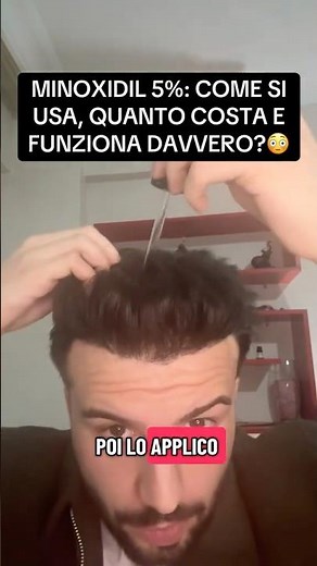 Minoxidil al 5%: pochi lo usano bene. Ecco cosa devi sapere davvero! #minoxidil #alopecia #capelli