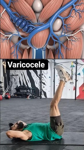 Varicocele Kegel Exercises for Men #varicocele #kegelexercises