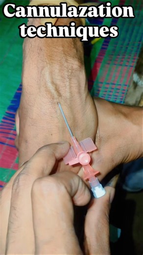 IV Cannulation Technique Explained | Peripheral IV Line Insertion | Nursing Skills #nurselife