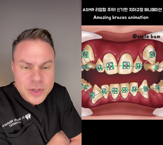 Weird Duet: Teeth Pulling to Braces? 😂