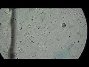 Smallest Creatures Under Microscope X200: Swimming Infusoria in Water, Ukraine, Ukrainain Pond.