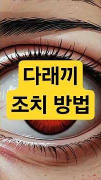 다래끼 증상 완화 및 조치 가이드