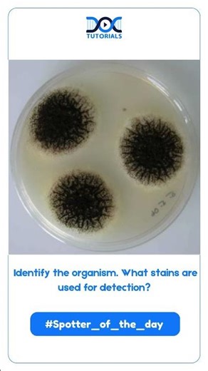 🧐 Spotter of the Day! | Identify the Organism & Its Stains