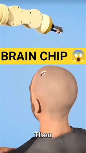 Elon Musk's Neuralink: Computer In Your Brain! 🧠🤖😱 #shortsfeed #shorts #science