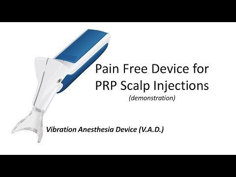 Vibration Anesthesia Device