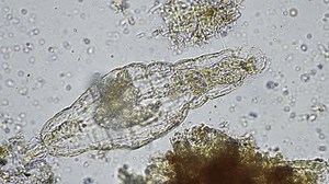 soil microorganisms close up under the microscope. in a soil sample from a farm