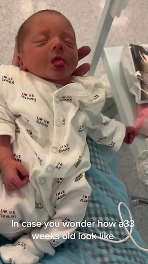 33 Weeks Baby: A Heartwarming Look at Premature Life