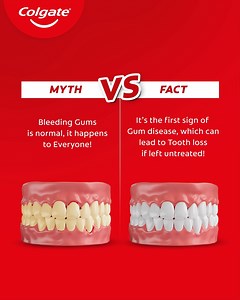 Don’t Ignore the Signs! Upgrade to Colgate Total for Complete Oral Health Protection*! *With daily 2X brushing, post 4 weeks of continued use. #ColgateTotal #AdvancedProtection #HealthyHabits #colgatenepal #Oralhealth #teethcare | Colgate Nepal