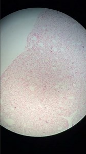 Processing Crab | Imitation Crab Under the Microscope