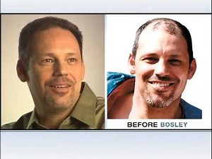 Bosley Medical TV Commercial - "Answers"