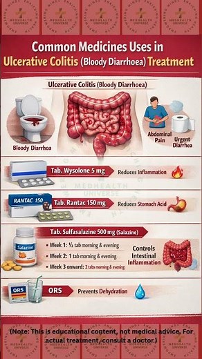 Ulcerative Colitis Treatment: Essential Medicines Explained #UlcerativeColitis #BloodyDiarrhoea