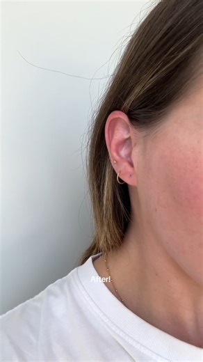 You can get a free pair of clear earrings when you get your ears pierced! PLUS a whole bag of free goodies! Book your next piercing appointment via the link in our bio ❤️‍🔥 #FreeGiveaways #EarPiercings #ClearEarrings | Essential Beauty & Piercing Australia