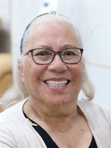 Removable dentures are the best option for people who have lost all their teeth but do not want dental implants! #CostatMetalDental #MetalDentalVietNam #NewZealand #MetalDental #dentalstudent #dentalhygienistny #australia #VietNam #Danang #Metal #teeth #dentist #dental #feelingsong #Process #Xuhuong #Viral #DentistVietNam #Foryou #removable