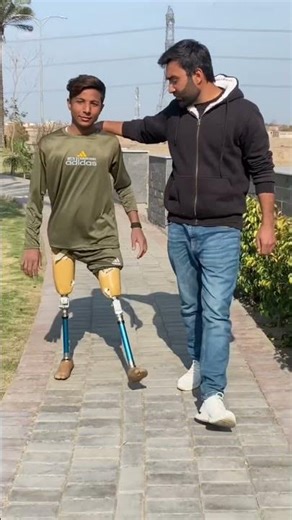 Fitting artificial above knee prosthesis leg / #hassanzarar #shortsfeed #artificialleg #humanleg