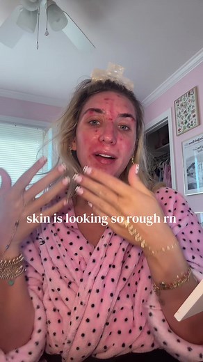 Dermatillomania & Contamination OCD: Skin Care and Makeup Tips