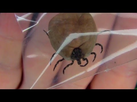 ATTACK OF THE KILLER TICKS!!!!! Does a tick have eyes? And other questions to ponder.