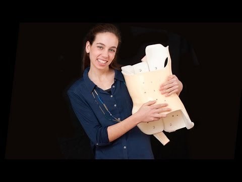 Embracing the Brace - Chloe & scoliosis - Boston Children's Hospital Orthopedic Center
