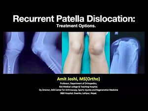 Recurrent patella dislocation Basic concept