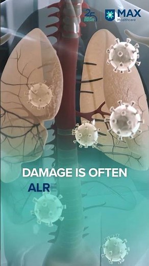 Why Lung Health is Often Missed in Routine Health Check-ups