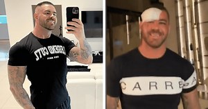 Dale Egan: Australia's 'porn king' survives almost fatal accident after riding scooter into wall