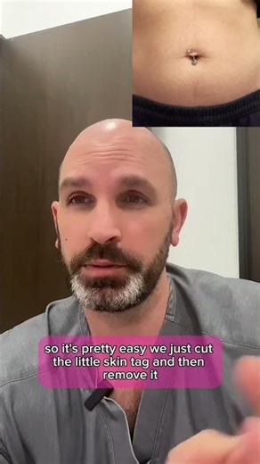 Stretched Out Belly Button Ring? Don't Worry! | Dr. Matthew J. Nykiel