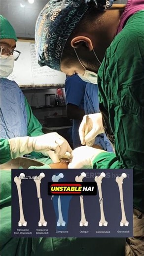 🤔Fracture me Plaster,Wire,Rod ya Plate- How I Decide?