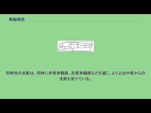 除脳硬直