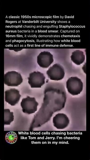 Immune Defense In Action As A White Blood Cell Pursues And Engulfs Staphylococcus Bacteria On Film