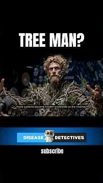 Why Is This Man Turning Into A Tree? #diseases #tree