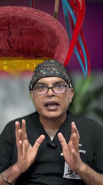 What is Prostate Artery Embolization | Enlarged Prostate Treatment Without Surgery | PAE Procedure