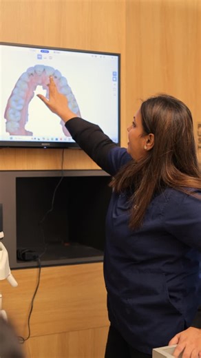 Shubham Dental Care on Instagram: "What is an intraoral scanner? It is a small handheld device that captures 3D impressions of your mouth which is fast , clean and accurate . - it is used for crown, bridge and veeneer fabrication - Faster lab communication - Orthodontic planning - ideal for aligners like invisilign or braces - Better patient communication - visualize problems on screen - More comfortable experience- no gagging or messy work , no impression material , no distortion - Time saving-