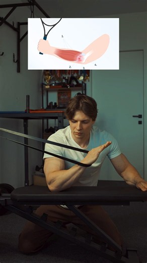 Tennis Elbow Rehab