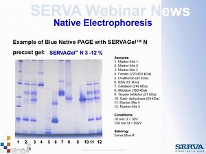 SERVA Webinar: Native Electrophoresis (English)