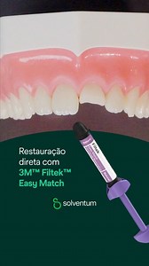 Veja na prática como a 3M™ Filtek™ Easy Match foi criada para facilitar cada etapa da restauração. Desde a seleção intuitiva de cores até a opacidade naturalmente adaptável, tudo foi pensado para oferecer eficiência clínica com resultados estéticos previsíveis — sem complicações. 👉 Já testou em seu consultório? Compartilhe nos comentários como foi sua experiência! #Solventum #SolventumDental #FiltekEasyMatch #Restauração | Solventum Dental