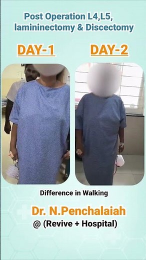 ✨ From Surgery to First Steps – Post Op Progress