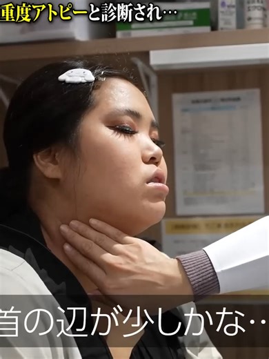 皮膚科でのアトピー治療について